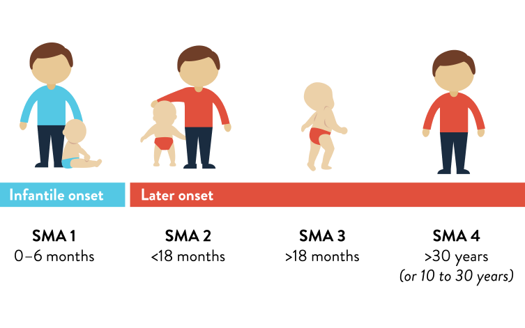 Are there different types of SMA?